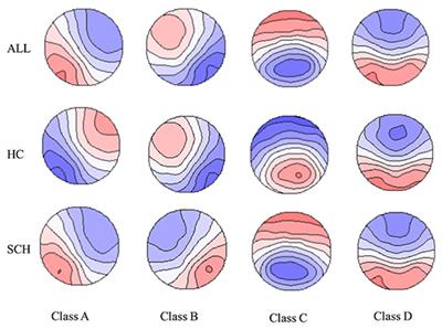 EEG Microstates and Its Relationship With Clinical Symptoms in Patients With Schizophrenia